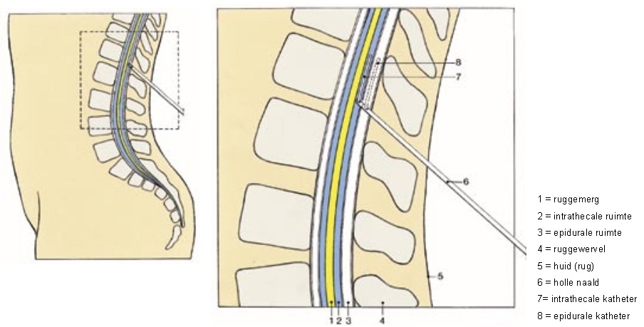 intrathecaleruimte